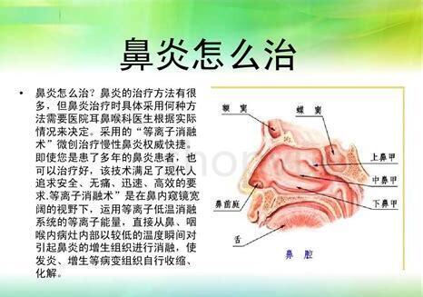 鼻炎怎么保养