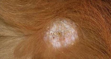 狗狗腿上长了癣怎么办