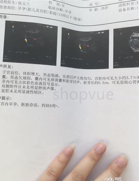猫怀孕60天出现褐色分泌物 猫怀孕60天出现褐色分泌物