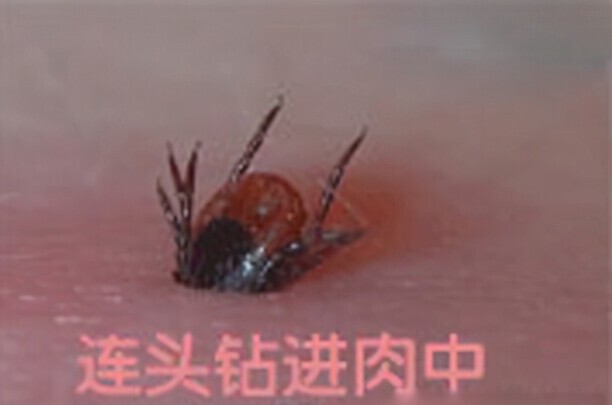 蜱虫在狗身上咋处理-狗身上有蜱虫怎么办